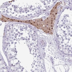VSIG10L Antibody, Novus Biologicals 25 &mu;L, Unlabeled:Antibodies, Polyclonal